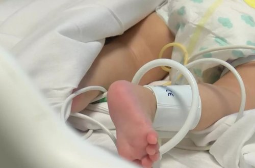 ABŞ və Avropada uşaqlar arasında ”hepatit” yoluxması artır