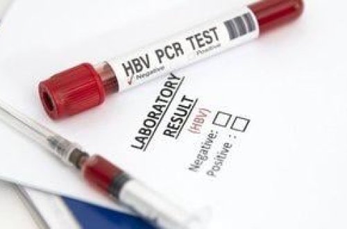 İsraildə 12 uşaqda sirli hepatit aşkarlanıb