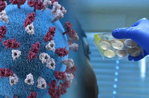 Ermənistanda COVID 19-a yoluxanların sayı 422 871 nəfərə çatıb