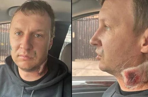 Nyu Yorkda ukranyalının rus olduğunu zənn edib döydülər