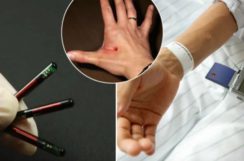 ABŞ-da insanları çipləməyə başlayıblar