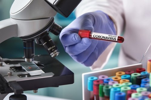 Azərbaycanda daha 8 nəfər koronavirusa yoluxub, ölən olmayıb