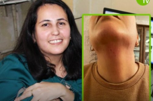 Jurnalist Aytən Məmmədova bıçaqlı hücuma məruz qalıb