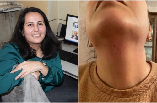 Jurnalist Aytən Məmmədovaya hücumla bağlı cinayət işi başlanılıb