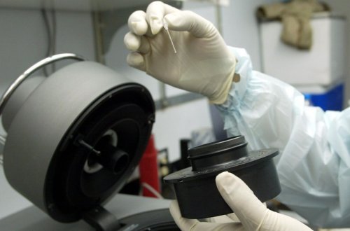 Portuqaliyada “Meymun çiçəyi”nə 20-dən çox yoluxma aşkarlanıb