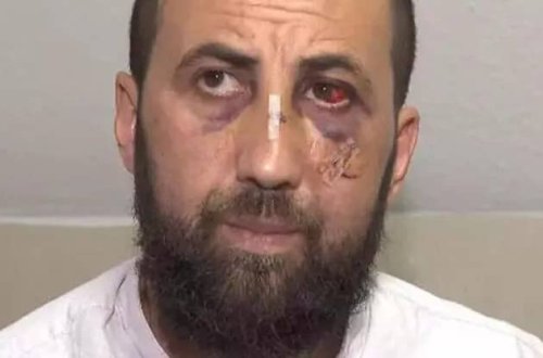 Almaniya polisi türk ailəsinə zor tətbiq etdi