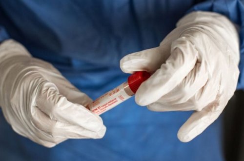 Meymunçiçəyi ilə bağlı daha bir xəbərdarlıq: Cinsi yolla keçir