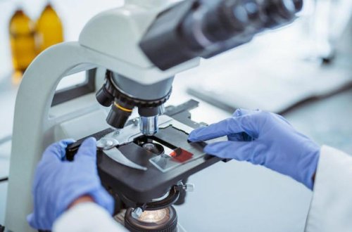 İspaniyada meymunçiçəyi virusunun genomu deşifrə edilib