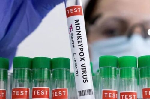 Almaniya meymunçiçəyi virusuna qarşı 240.000 doza peyvənd sifariş edib