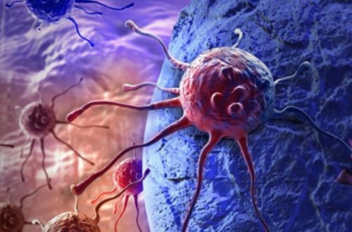 Çətin müalicə olunan xərçəng şişləri belə məhv ediləcək - YENİ KƏŞF