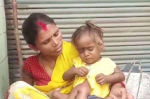 Dörd qolu və dörd ayağı olan “hörümçək qız” - VİDEO