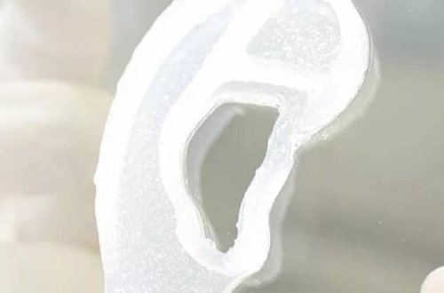 ABŞ-da bir ilk: 3D qulaq nəqli edilib