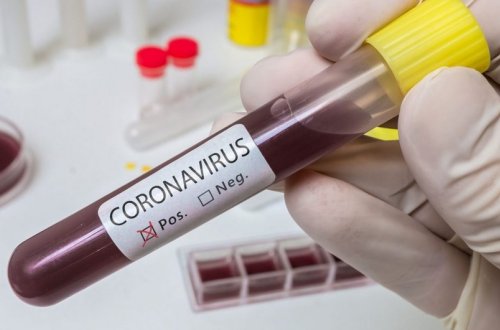 Azərbaycanda daha 15 nəfər koronavirusa yoluxub, ölən olmayıb