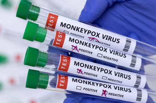 Bu ölkədə meymunçiçəyinə ilk yoluxma halı qeydə alındı