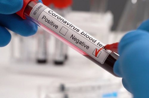 ABŞ-a səyahət edən şəxslərdən COVID-19 testi tələb olunmayacaq