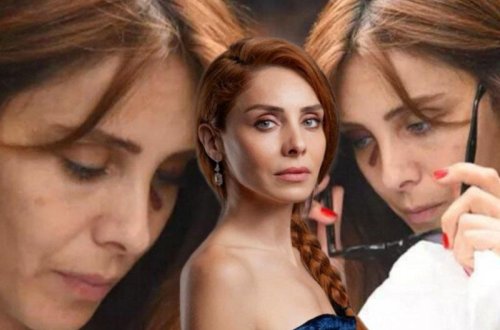 Üzündəki yaranı gizlətmək üçün eynək taxdı - FOTOlar