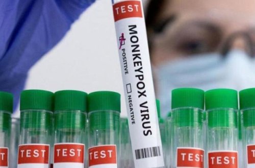 Daha bir ölkədə meymunçiçəyinə ilk yoluxma qeydə alındı