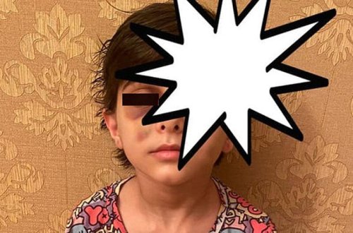 Üç azyaşlı anasının sevgilisi tərəfindən döyüldü - DİN-dən açıqlama