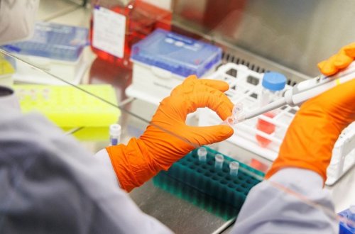 Meymunçiçəyi xəstəliyinin diaqnostika qaydaları açıqlanıb