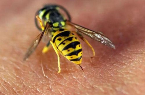 Arı sancmasına adi hal kimi yanaşmaq olmaz - XƏBƏRDARLIQ - VİDEO