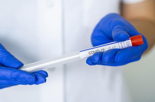 İranda son sutkada 5000 yoluxma qeydə alındı