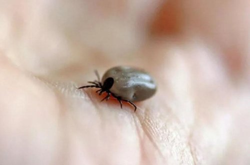 Gənə dişləməsindən dünyasını dəyişdi - Mütəxəssislər xəbərdarlıq etdi - VİDEO