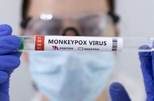 ÜST: İndiyədək 14 min nəfər meymunçiçəyinə yoluxub