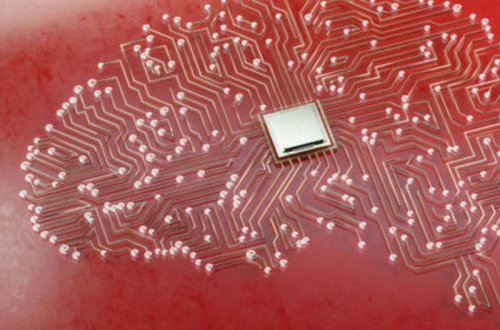 İlk dəfə olaraq insan beyninə daimi implant yeridildi