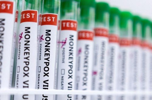 Fransada meymunçiçəyinə qarşı peyvənd mərkəzi açılıb