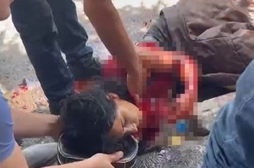 Sevgilisi 21 yaşlı qızı küçədə bıçaqladı