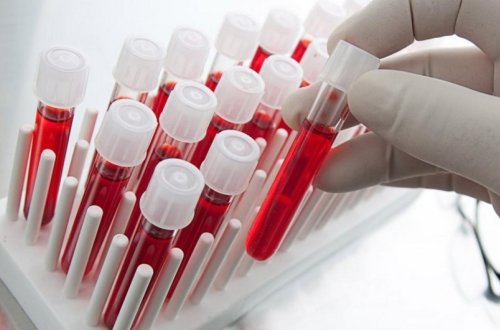 Son aylar Azərbaycanda hepatitlə bağlı müraciət edənlərin sayı açıqlanıb