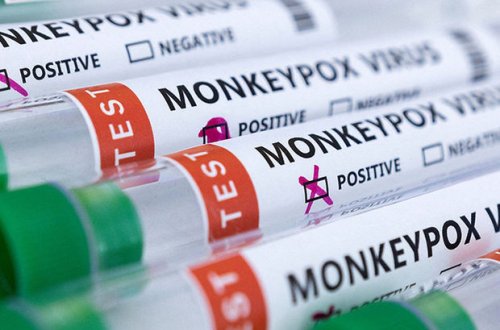 Britaniya alimləri meymunçiçəyinin “ədəbsiz” əlamətlərini açıqlayıblar