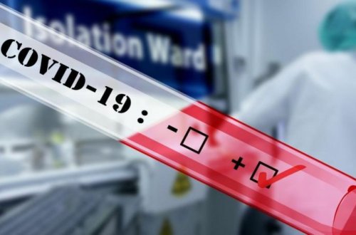 Azərbaycanda son sutkada 102 nəfər koronavirusa yoluxub