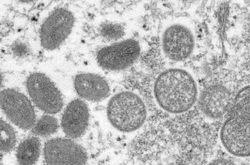 Hindistanda meymun çiçəyi ilə əlaqəli ilk ölüm qeydə alınıb