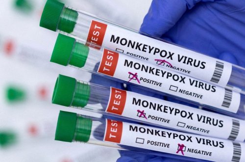 TƏBİB meymunçiçəyindən qorunmağın üsullarını açıqlayıb