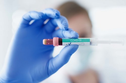 Azərbaycanda son sutkada 710 nəfər koronavirusa yoluxub