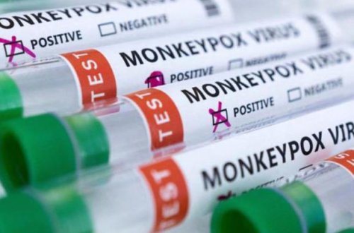 İki ölkədə meymunçiçəyindən ölümlər qeydə alınıb