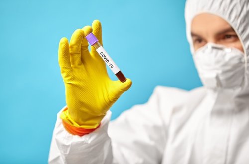 Son sutkada Azərbaycanda 132 nəfər koronavirusa yoluxub, ölən olmayıb