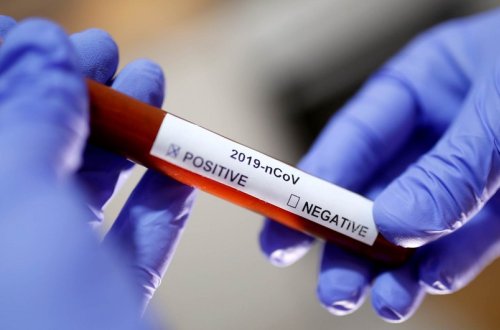 Son sutkada Azərbaycanda 621 nəfər koronavirusa yoluxub