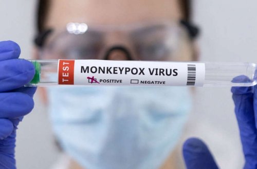 Dünyada meymunçiçəyinə yoluxma hallarının sayı 50 mini keçib