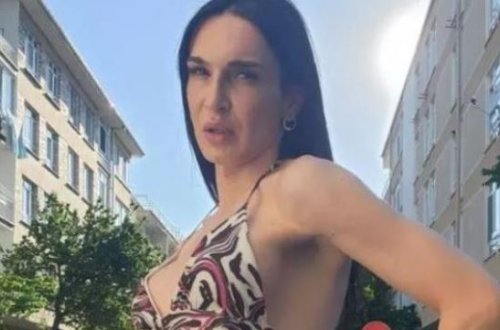 Cinsini dəyişdirən aktyor bu dəfə estetiklə gündəmə gəldi