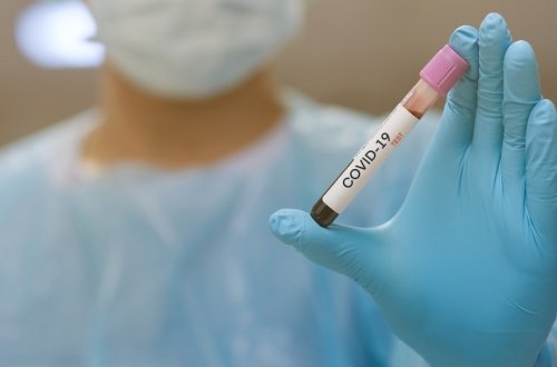 Son sutkada Azərbaycanda 325 nəfər koronavirusa yoluxub, 7 nəfər ölüb