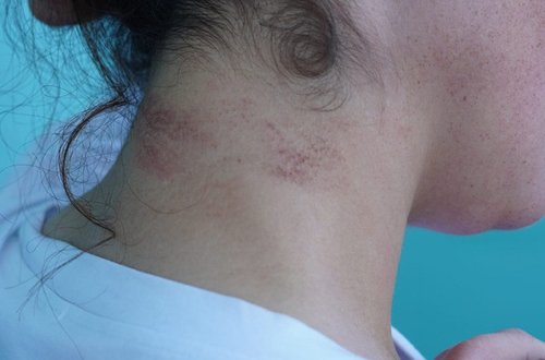 Yeznəsinə zorla ərə verilən qadınla bağlı açıqlama verilib