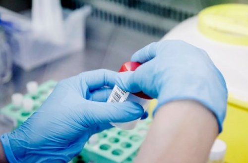 Bu ölkədə uşaqda meymunçiçəyi aşkarlandı