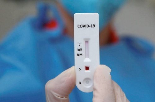 Rusiyalı mikrobioloq alim: “Koronavirus ştamları təxminən hər səkkiz aydan bir dəyişir”