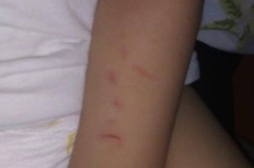 Bir yaşlı uşağın bağçada döyülməsi iddiası ilə bağlı RƏSMİ AÇIQLAMA - YENİLƏNİB + FOTO