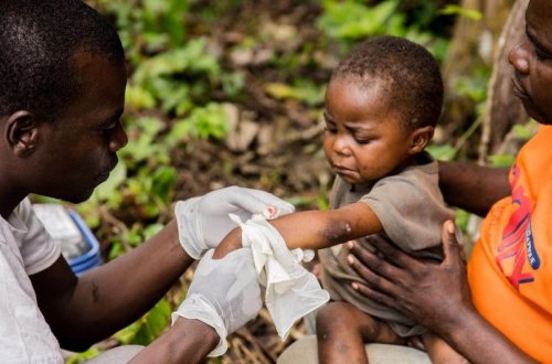 Dünyada meymunçiçəyinə yoluxma sayı 62 mini keçib