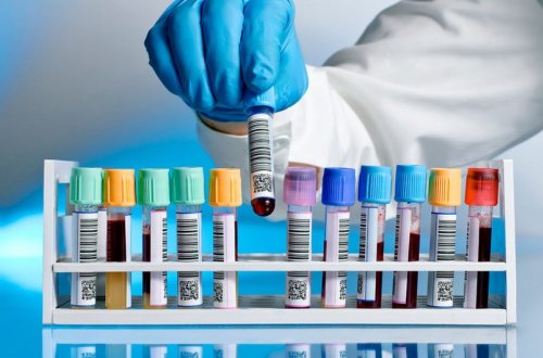 Son sutkada Azərbaycanda 214 nəfər koronavirusa yoluxub, 2 nəfər ölüb