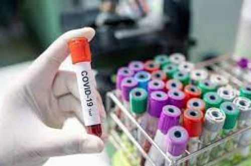 Dünyada COVID-19-a yoluxanların sayı 624 milyon nəfəri ötüb