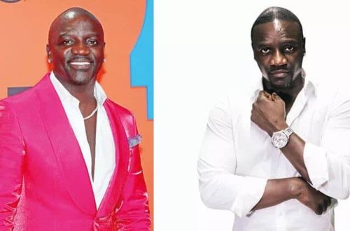 Dünyaca məşhur müğənni Akon Türkiyədə saç əkdirib